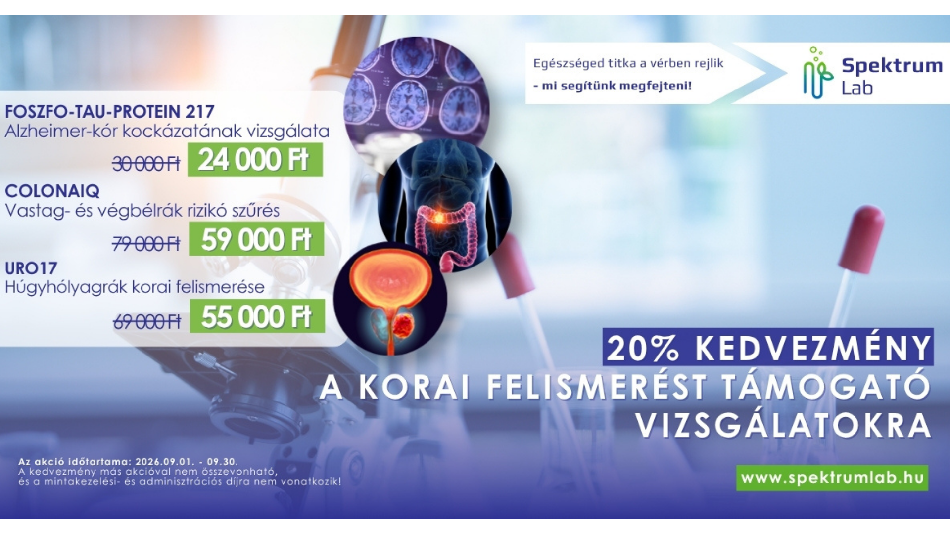 Spektrumlab megelőzést támogató akció